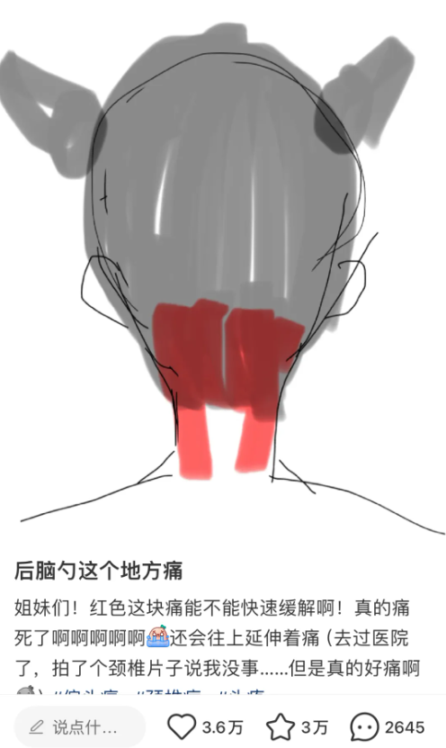 盈富配资 后脑勺这里疼，不是偏头痛