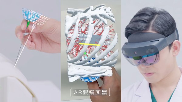 汇金财富 复拓知达自研肺结节术中定位AI